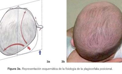 plagio2